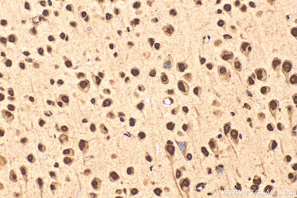 IHC staining of mouse brain using 10829-1-AP Immunohistochemistry (IHC) staining of mouse brain tissue using HMGB1 Polyclonal antibody (10829-1-AP)