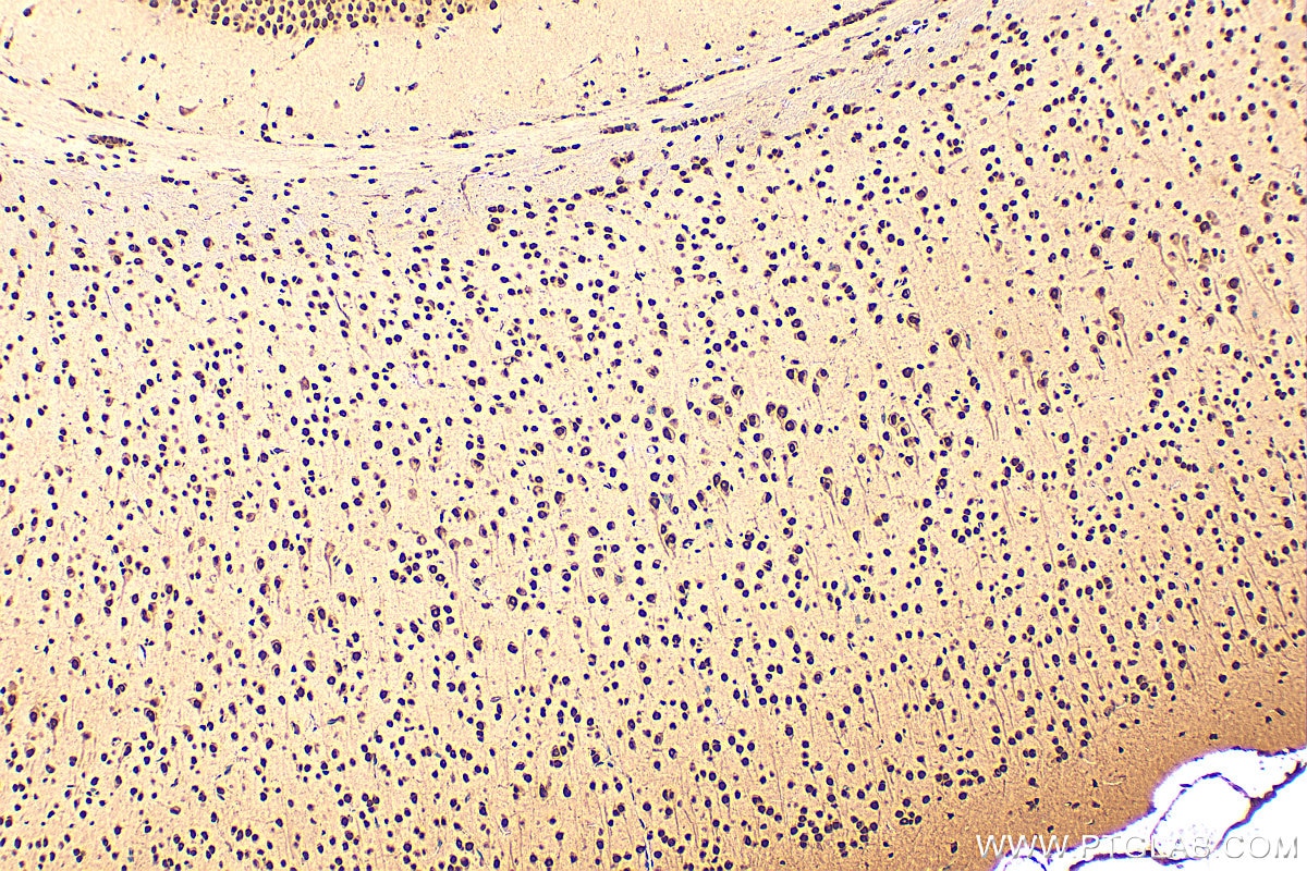 Immunohistochemistry (IHC) staining of mouse brain tissue using HMGB1 Polyclonal antibody (10829-1-AP)