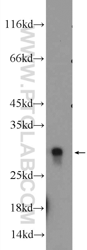 Western Blot (WB) analysis of rat stomach tissue using HMGB1 Polyclonal antibody (10829-1-AP)