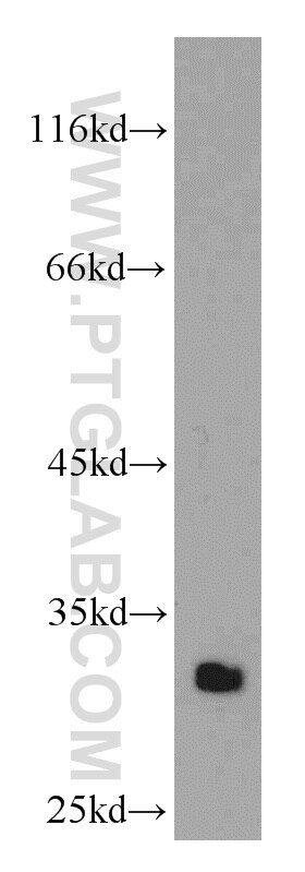 Western Blot (WB) analysis of mouse kidney tissue using HMGB1 Polyclonal antibody (10829-1-AP)