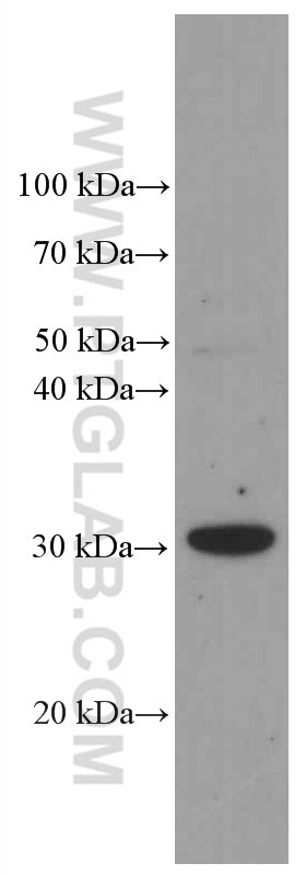 Western Blot (WB) analysis of Jurkat cells using HMGB1 Monoclonal antibody (66525-1-Ig)