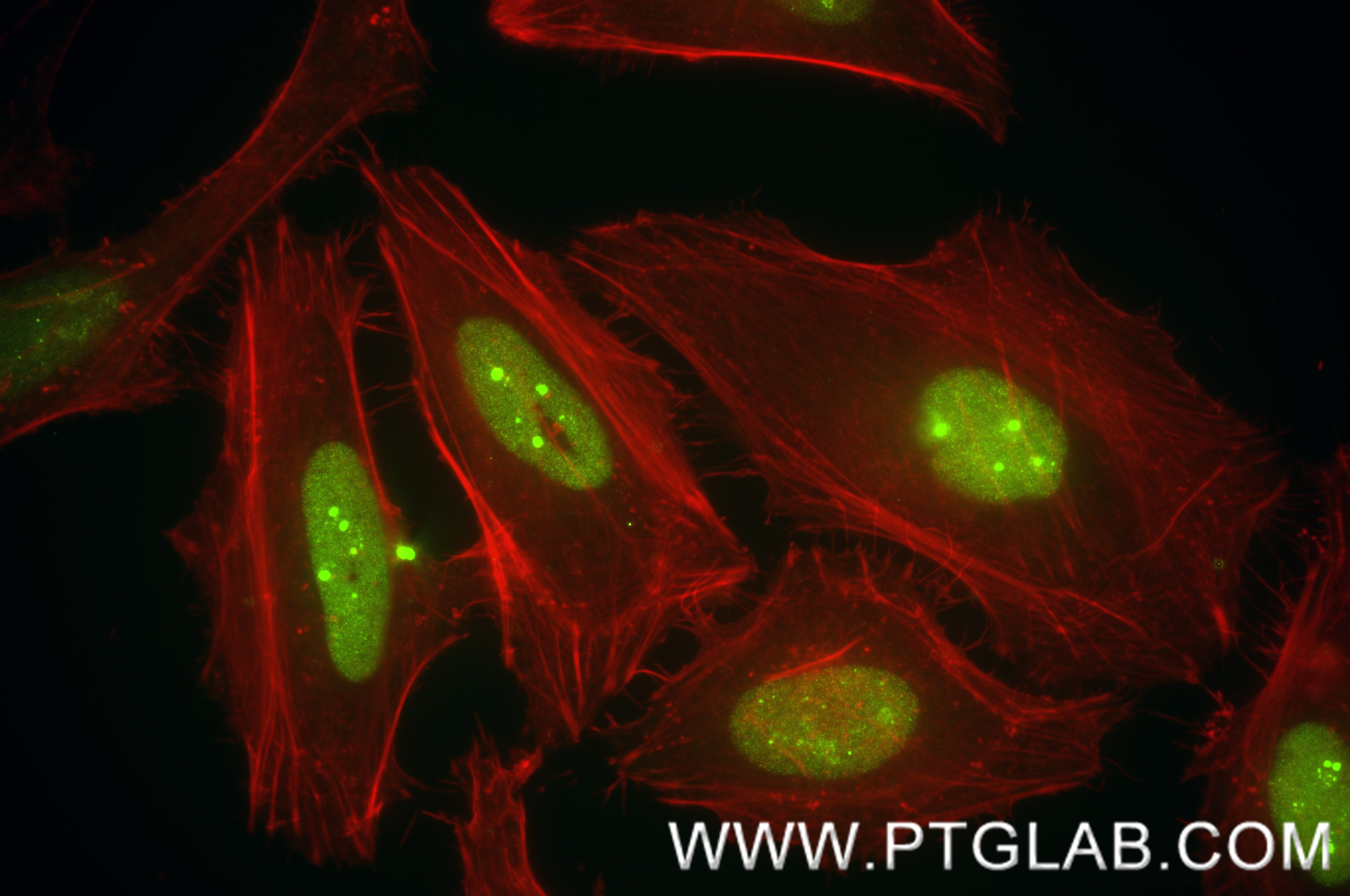 Immunofluorescence (IF) / fluorescent staining of HeLa cells using HMGB1 Recombinant monoclonal antibody, PBS Only (82973-1-PBS)