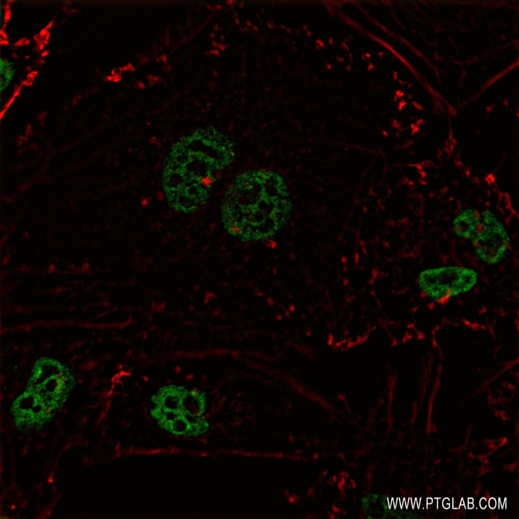 IF Staining of HeLa using 82973-1-RR