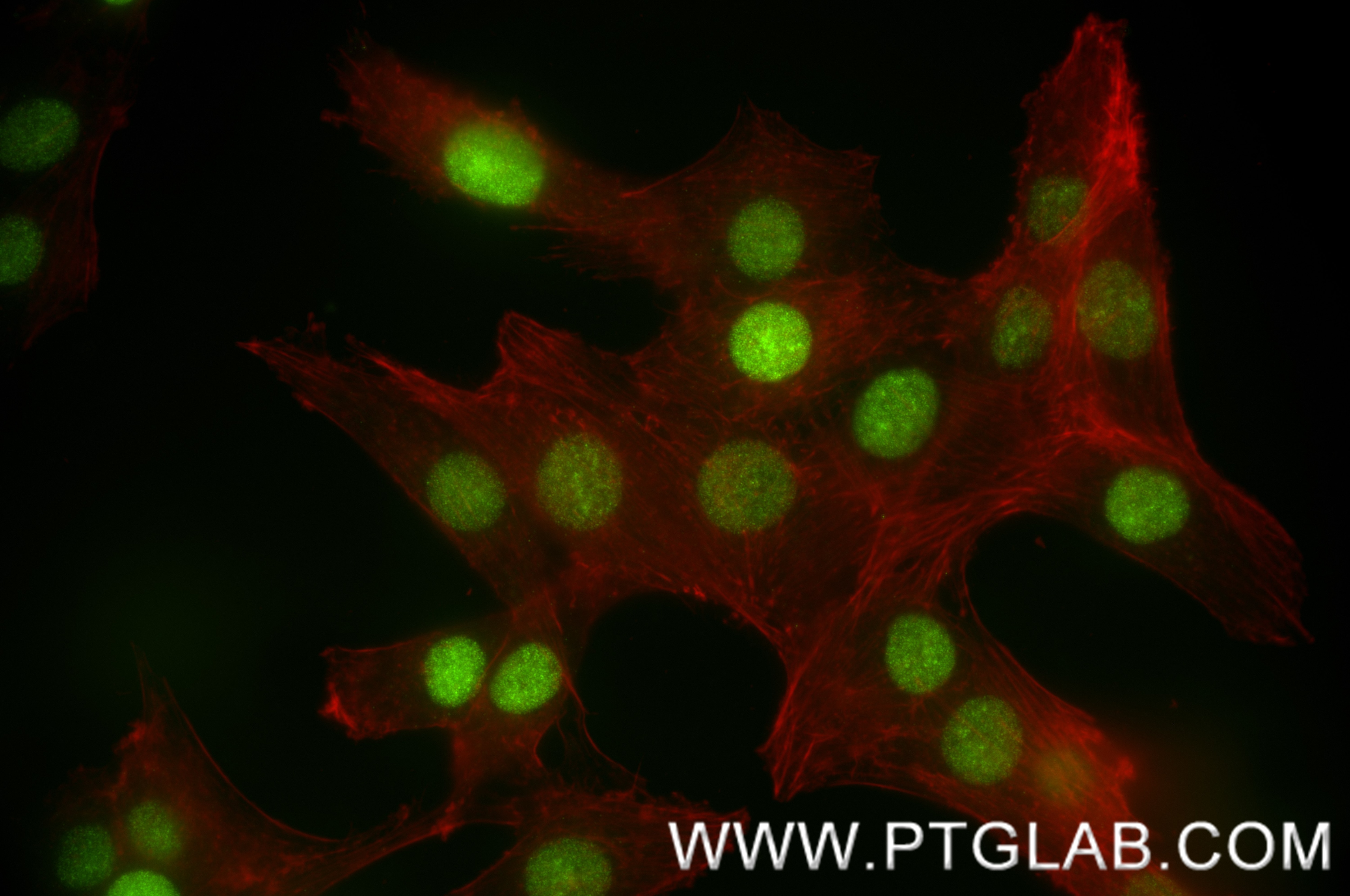 IF Staining of C6 using 82973-1-RR Immunofluorescence (IF) / fluorescent staining of C6 cells using HMGB1 Recombinant monoclonal antibody (82973-1-RR)