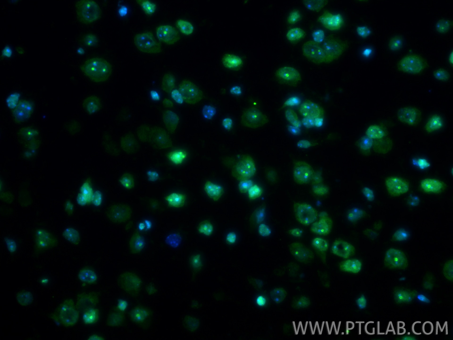 Immunofluorescence (IF) / fluorescent staining of mouse brain tissue using HMGB1 Recombinant monoclonal antibody (82973-1-RR)