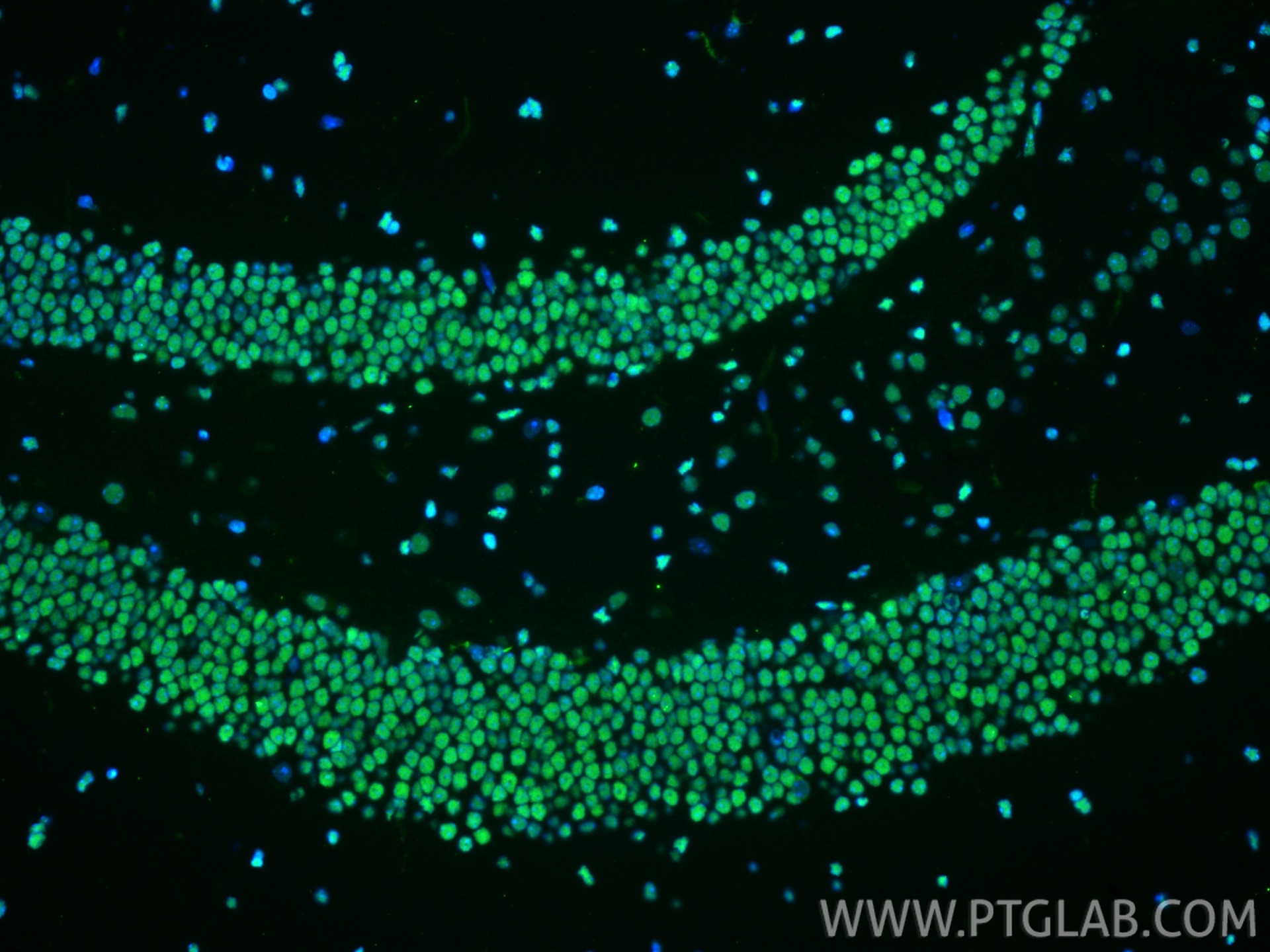 Immunofluorescence (IF) / fluorescent staining of mouse brain tissue using HMGB1 Recombinant monoclonal antibody (82973-1-RR)