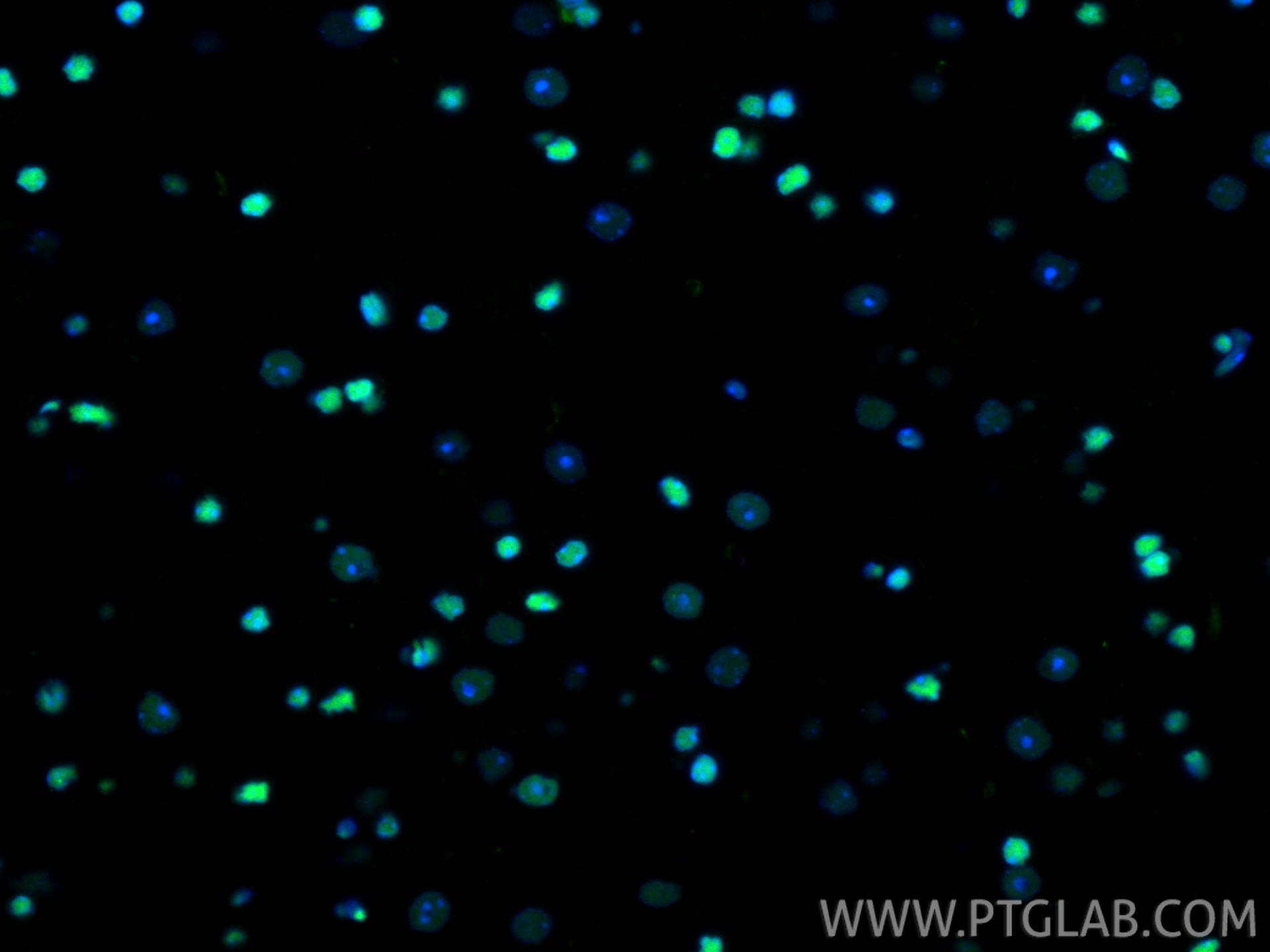 Immunofluorescence (IF) / fluorescent staining of mouse brain tissue using HMGB1 Recombinant monoclonal antibody (82973-1-RR)