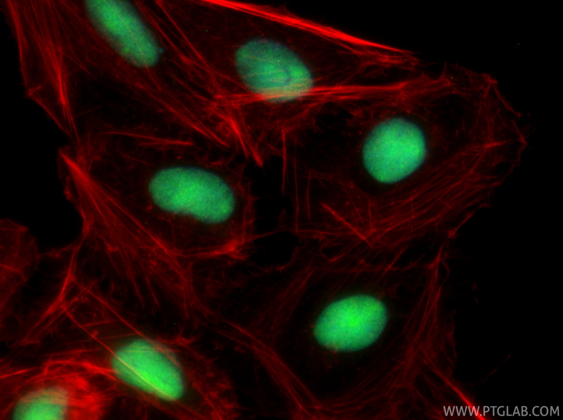 IF Staining of U2OS using 82973-1-RR Immunofluorescence (IF) / fluorescent staining of U2OS cells using HMGB1 Recombinant monoclonal antibody (82973-1-RR)