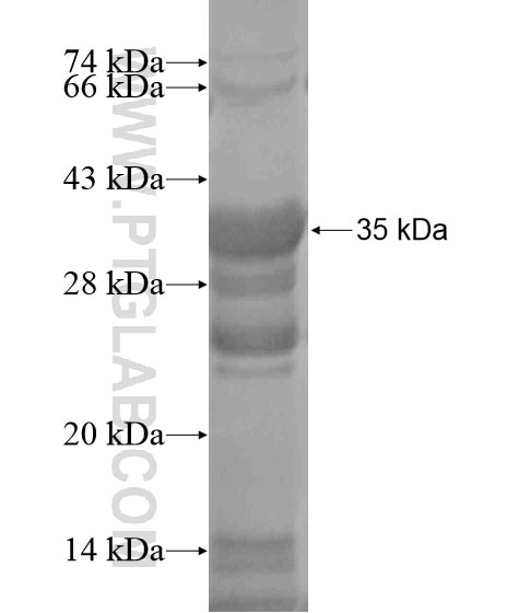 HMGB1 fusion protein Ag20397 SDS-PAGE