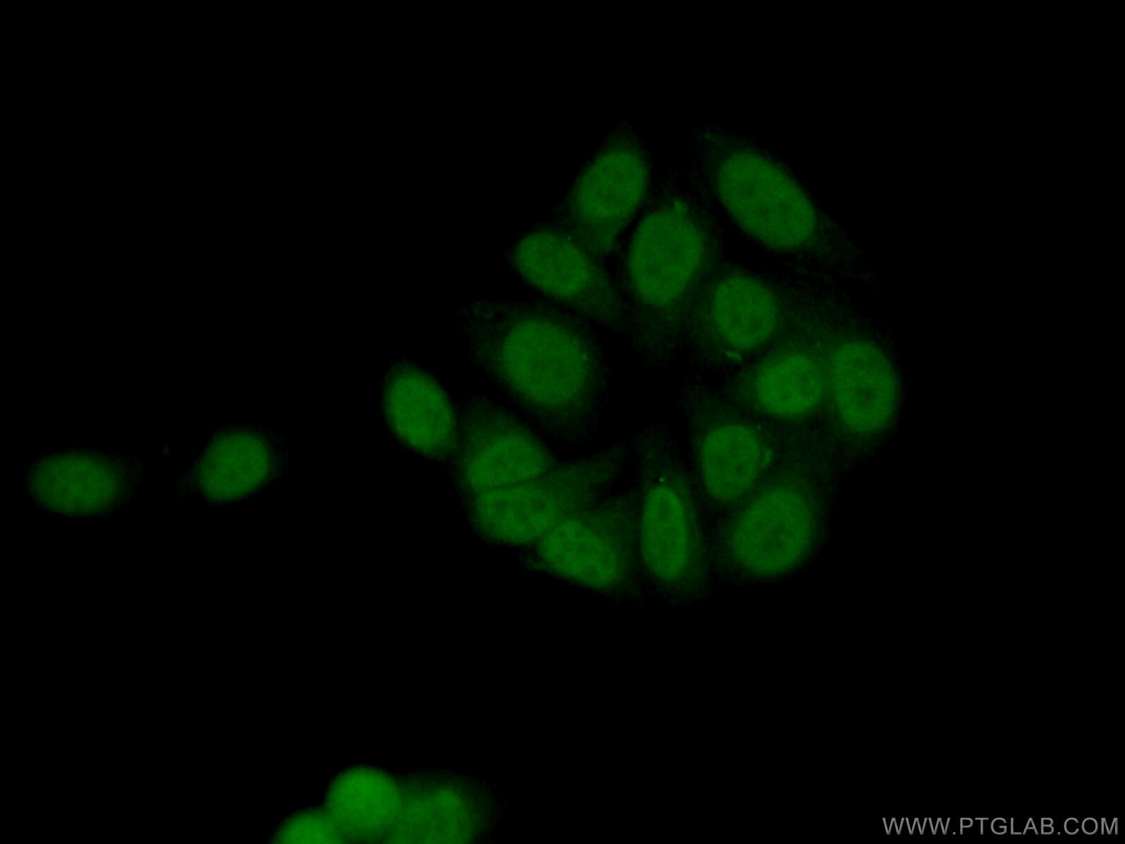 Immunofluorescence (IF) / fluorescent staining of HepG2 cells using HMGB2 Polyclonal antibody (14597-1-AP)