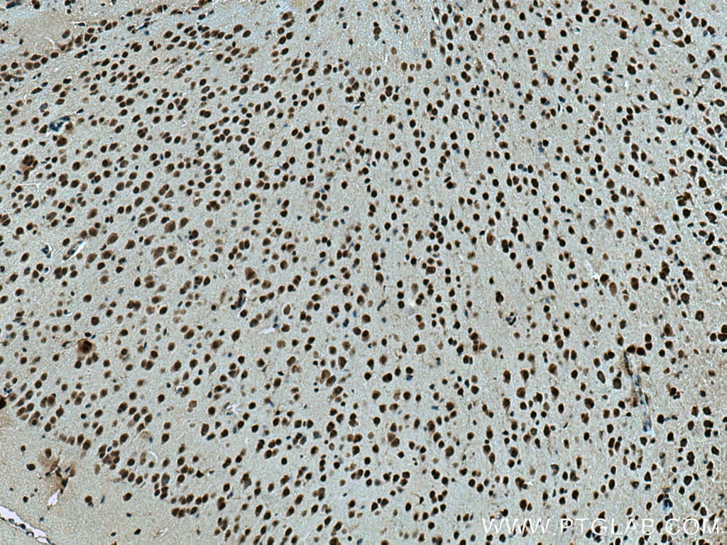 Immunohistochemistry (IHC) staining of mouse brain tissue using HMGB2 Polyclonal antibody (14597-1-AP)