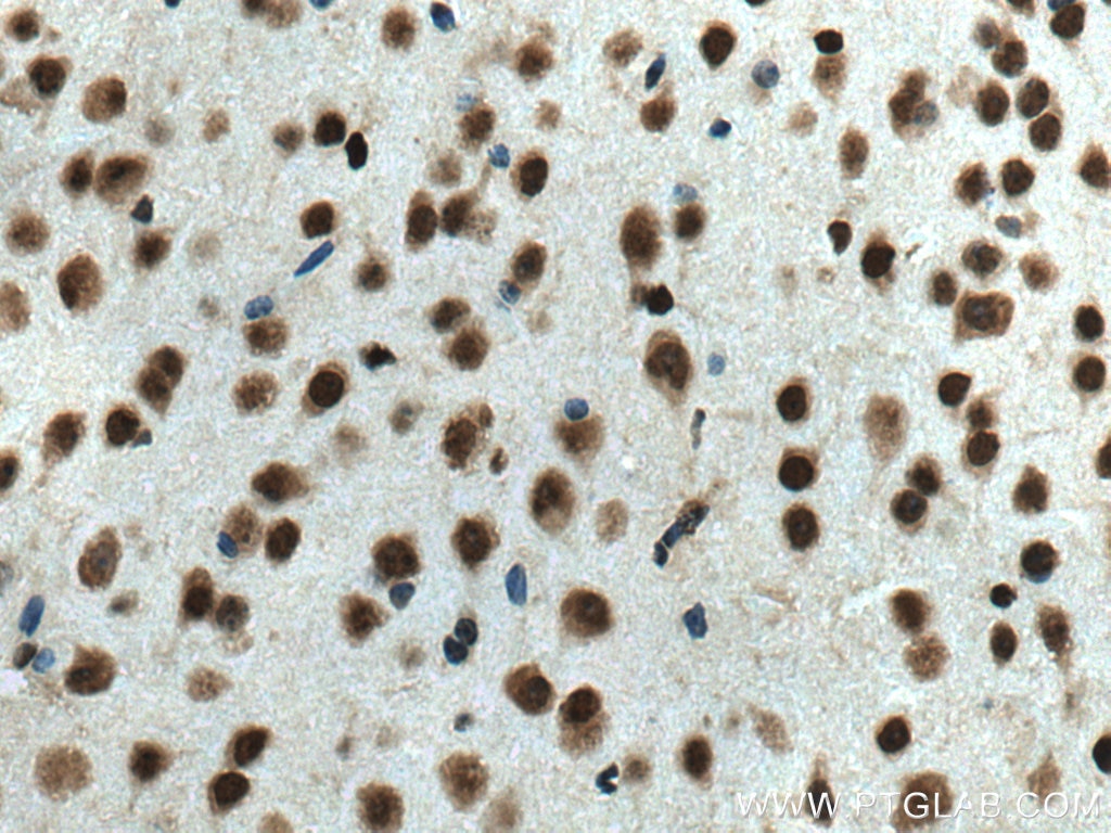 Immunohistochemistry (IHC) staining of mouse brain tissue using HMGB2 Polyclonal antibody (14597-1-AP)