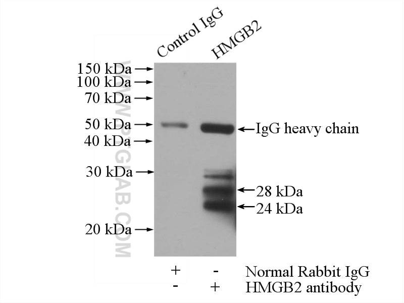 Immunoprecipitation (IP) experiment of HEK-293 cells using HMGB2 Polyclonal antibody (14597-1-AP)