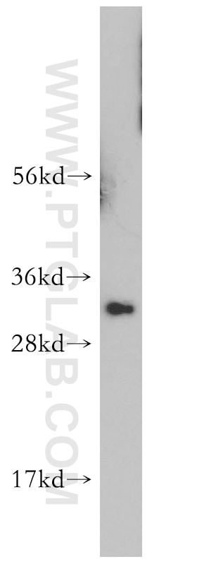 Western Blot (WB) analysis of human cerebellum tissue using HMGB2 Polyclonal antibody (14597-1-AP)