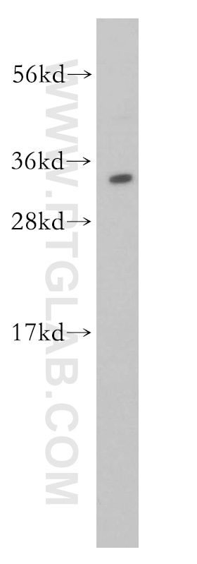 Western Blot (WB) analysis of Jurkat cells using HMGB2 Polyclonal antibody (14597-1-AP)