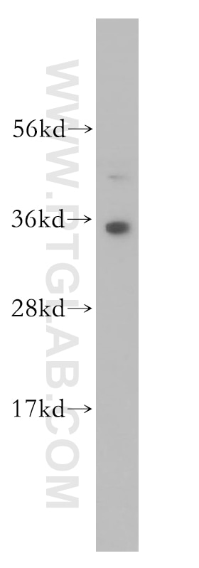 WB analysis of HEK-293 using 14597-1-AP