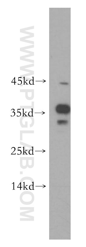 Western Blot (WB) analysis of K-562 cells using HMGB2 Polyclonal antibody (14597-1-AP)