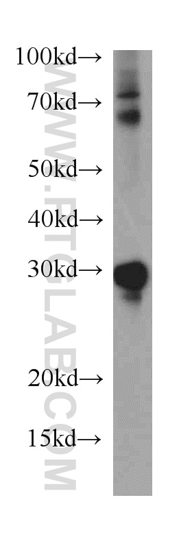 Western Blot (WB) analysis of HEK-293 cells using HMGB2 Polyclonal antibody (15605-1-AP)