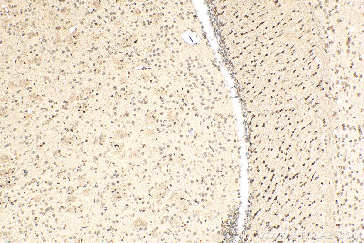 Immunohistochemistry (IHC) staining of mouse brain tissue using HMGB2 Monoclonal antibody (68185-1-Ig)