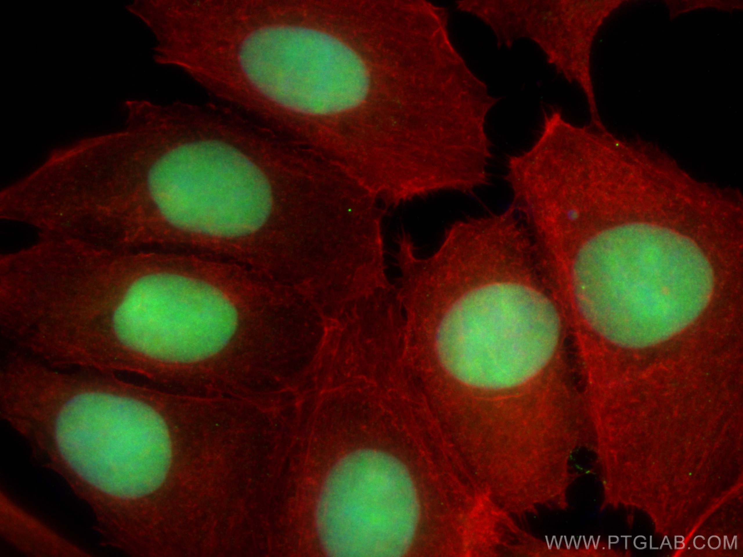 Immunofluorescence (IF) / fluorescent staining of MCF-7 cells using HMGB3 Polyclonal antibody (27465-1-AP)
