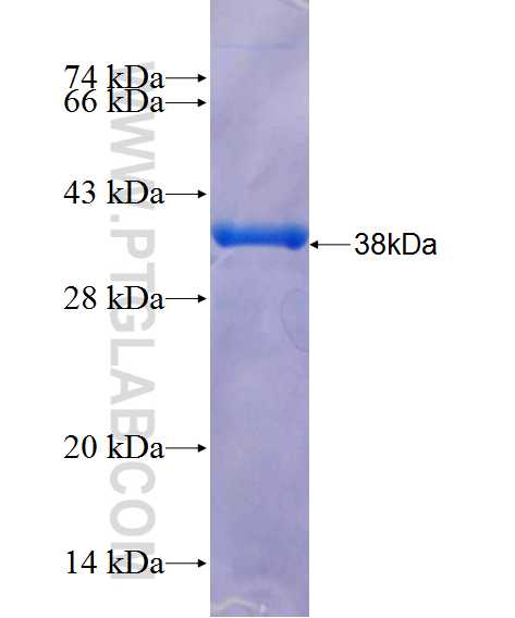 HMGB3 fusion protein Ag26361 SDS-PAGE