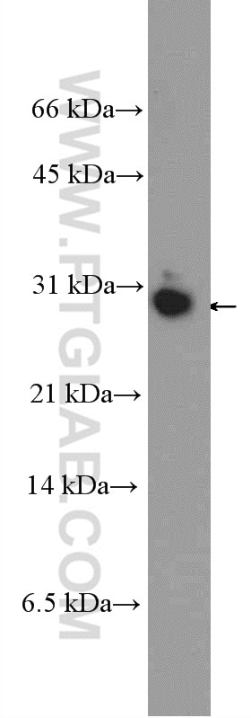 Western Blot (WB) analysis of HeLa cells using HMGB3L1 Polyclonal antibody (21246-1-AP)