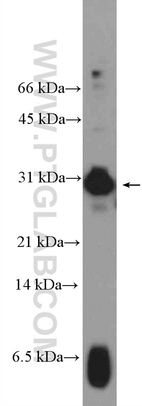 Western Blot (WB) analysis of human placenta tissue using HMGB3L1 Polyclonal antibody (21246-1-AP)