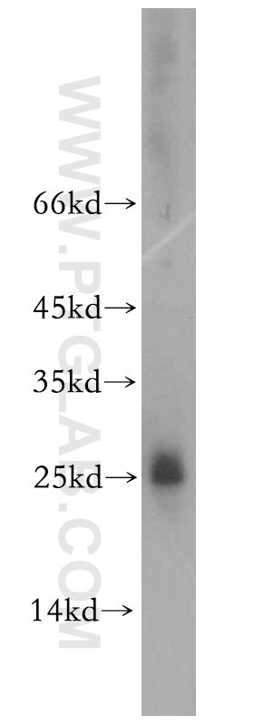 Western Blot (WB) analysis of human testis tissue using HMGB4 Polyclonal antibody (12787-1-AP)