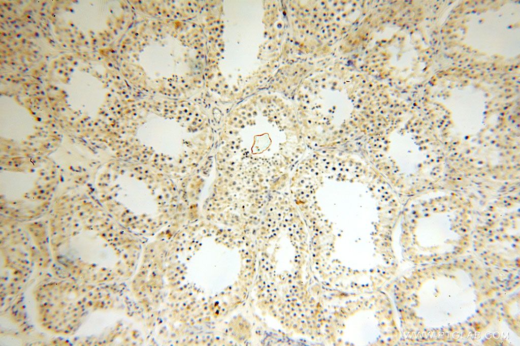 Immunohistochemistry (IHC) staining of human testis tissue using HMGCL Polyclonal antibody (16898-1-AP)