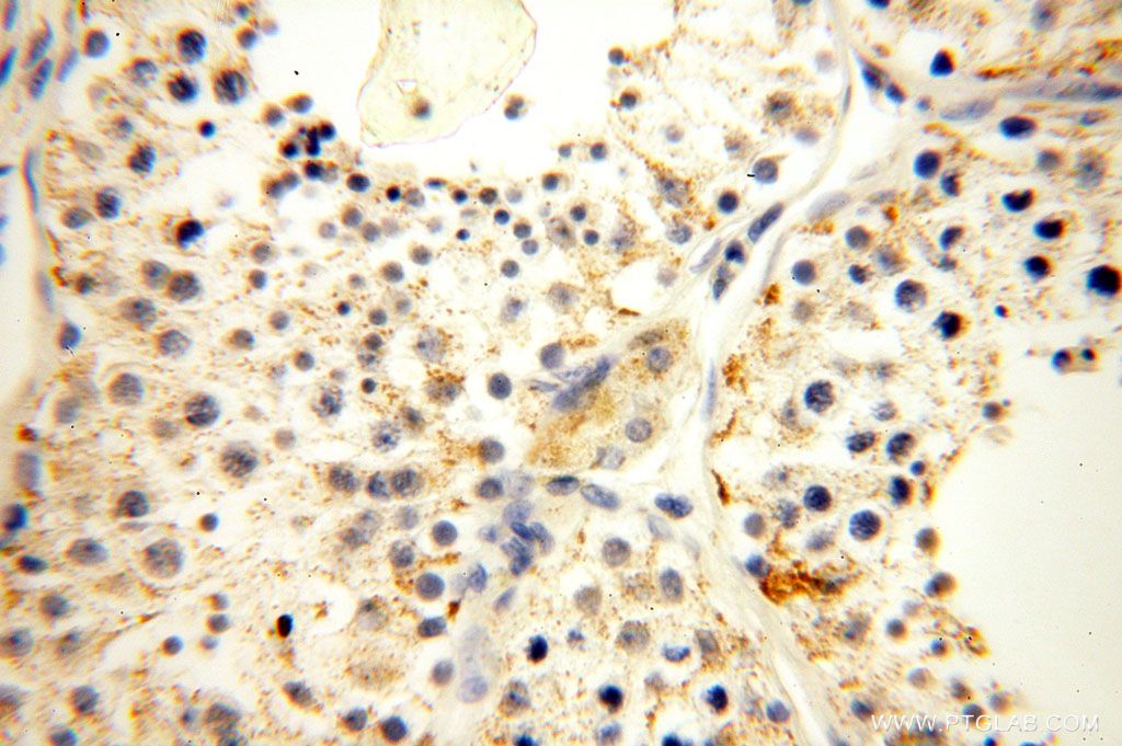 Immunohistochemistry (IHC) staining of human testis tissue using HMGCL Polyclonal antibody (16898-1-AP)