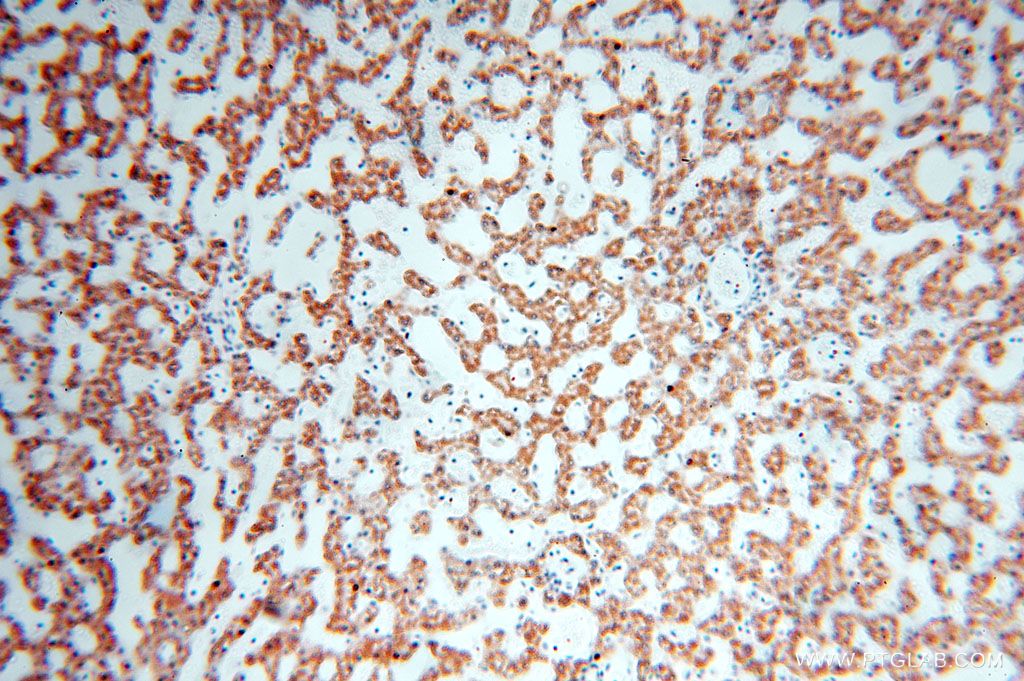 Immunohistochemistry (IHC) staining of human liver tissue using HMGCL Polyclonal antibody (16898-1-AP)