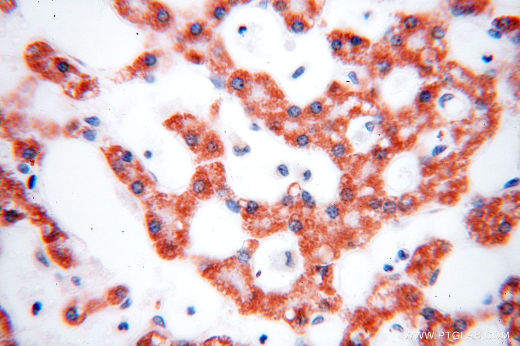 Immunohistochemistry (IHC) staining of human liver tissue using HMGCL Polyclonal antibody (16898-1-AP)