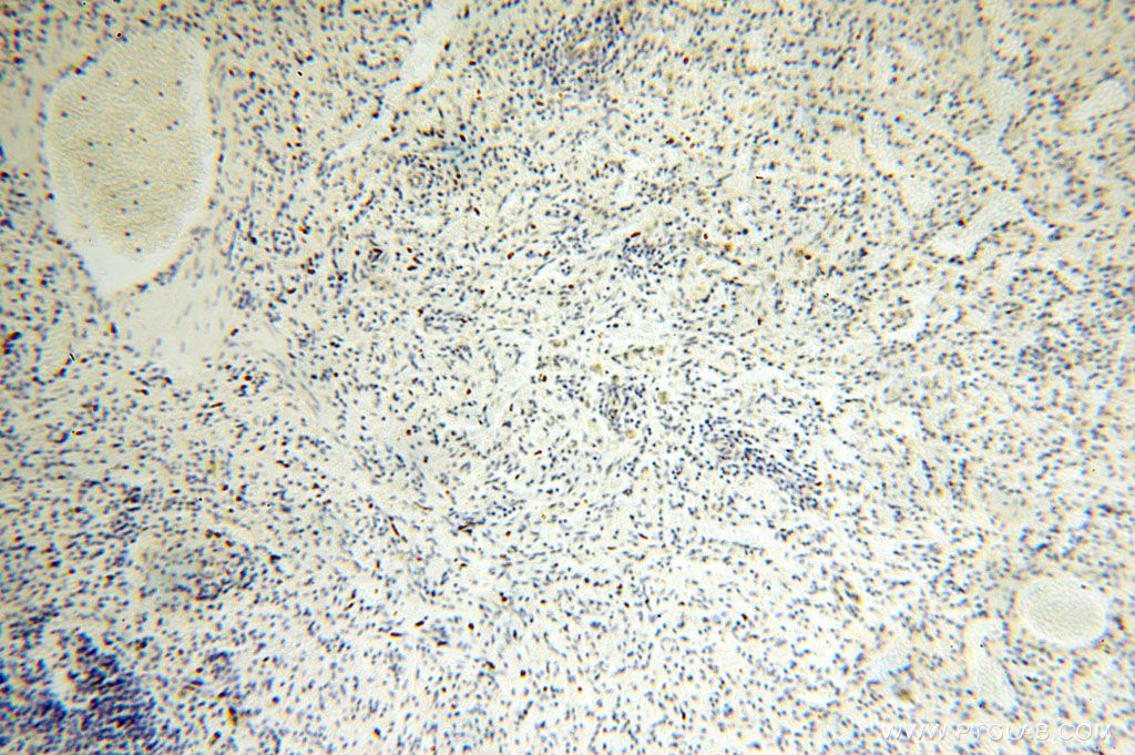 IHC staining of human spleen using 16898-1-AP