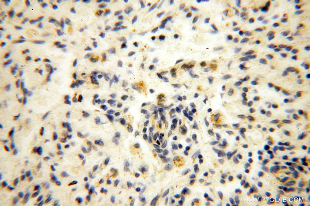 Immunohistochemistry (IHC) staining of human spleen tissue using HMGCL Polyclonal antibody (16898-1-AP)