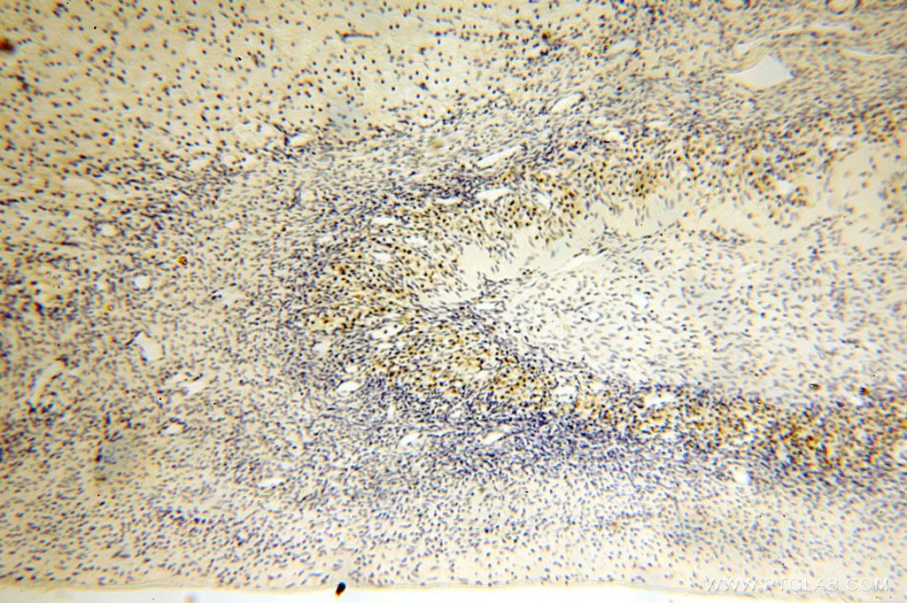Immunohistochemistry (IHC) staining of human ovary tissue using HMGCL Polyclonal antibody (16898-1-AP)