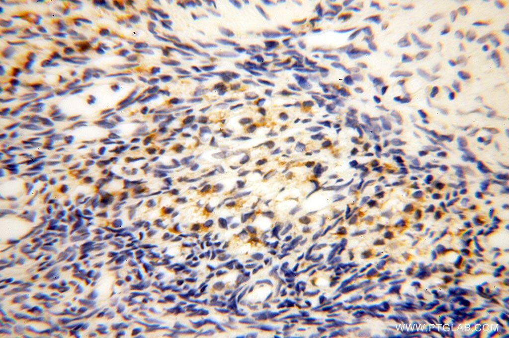 Immunohistochemistry (IHC) staining of human ovary tissue using HMGCL Polyclonal antibody (16898-1-AP)