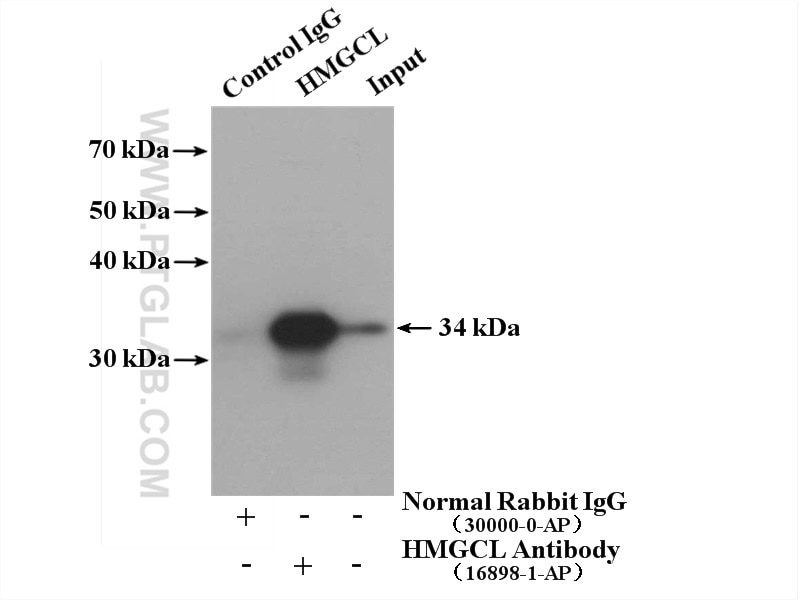 Immunoprecipitation (IP) experiment of mouse spleen tissue using HMGCL Polyclonal antibody (16898-1-AP)