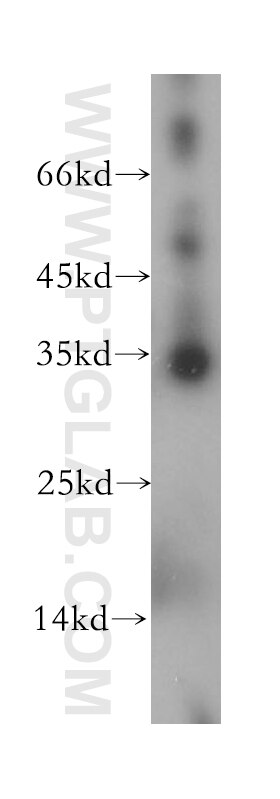 Western Blot (WB) analysis of human heart tissue using HMGCL Polyclonal antibody (16898-1-AP)
