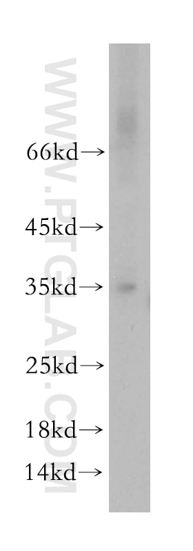 Western Blot (WB) analysis of mouse brain tissue using HMGCL Polyclonal antibody (16898-1-AP)