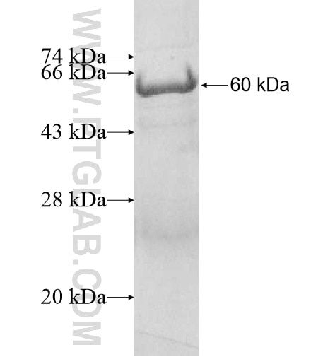HMGCL fusion protein Ag10426 SDS-PAGE