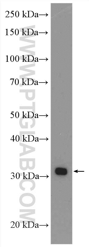 Western Blot (WB) analysis of SKOV-3 cells using HMGCLL1 Polyclonal antibody (17206-1-AP)