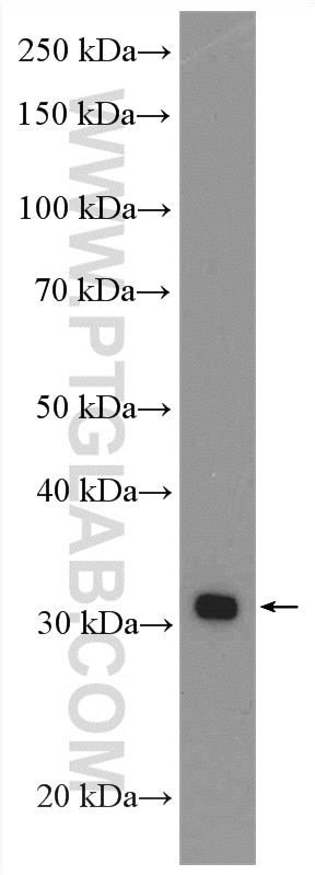 Western Blot (WB) analysis of SKOV-3 cells using HMGCLL1 Polyclonal antibody (17206-1-AP)