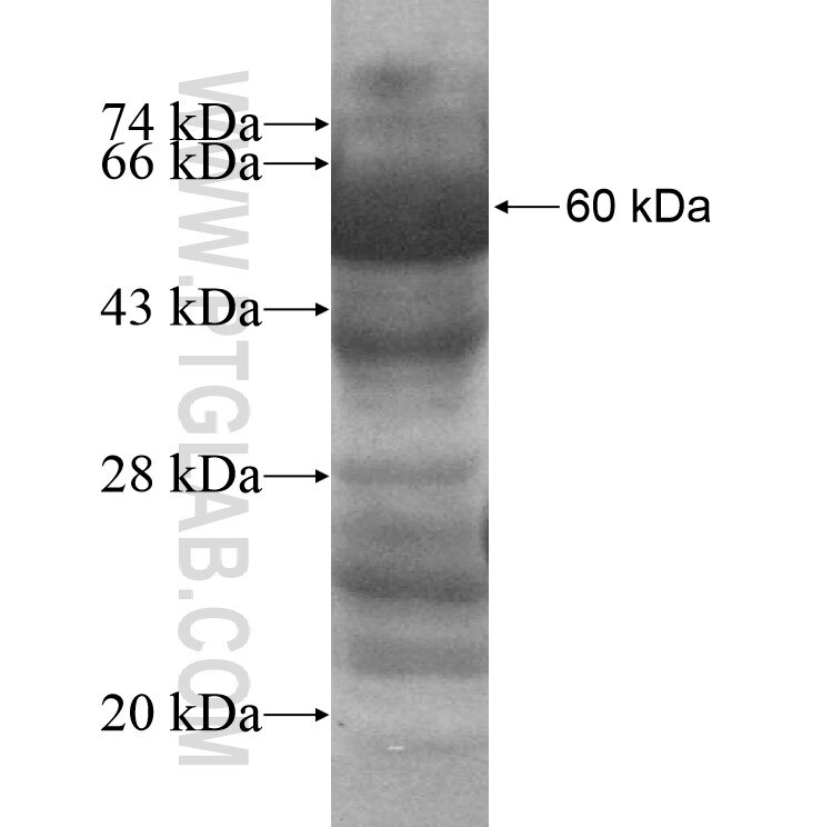HMGCLL1 fusion protein Ag10985 SDS-PAGE