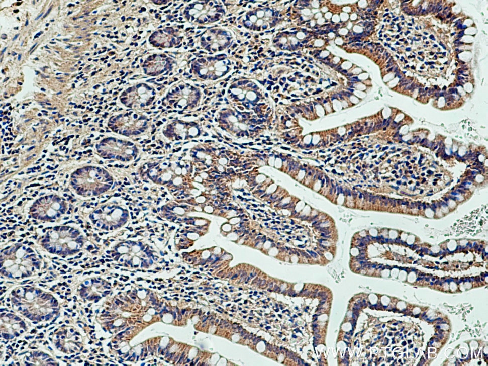 Immunohistochemistry (IHC) staining of human small intestine tissue using HMGCR Polyclonal antibody (13533-1-AP)