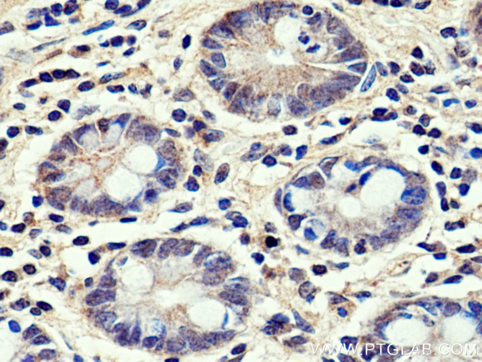 Immunohistochemistry (IHC) staining of human small intestine tissue using HMGCR Polyclonal antibody (13533-1-AP)