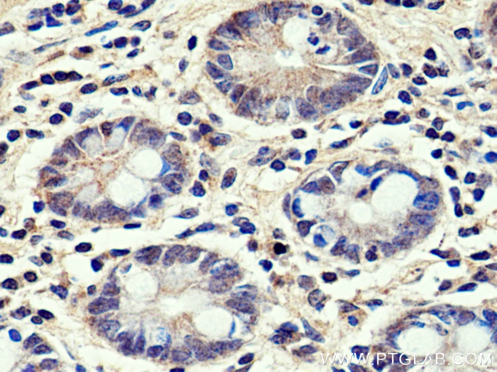 IHC staining of human small intestine using 13533-1-AP