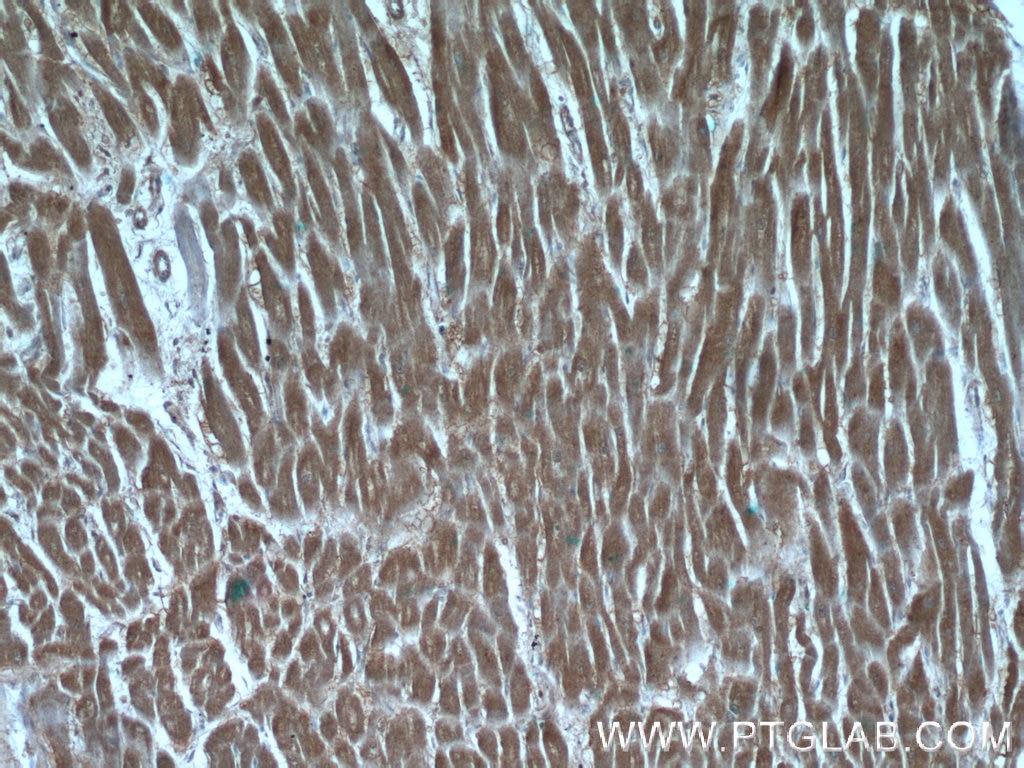 Immunohistochemistry (IHC) staining of human heart tissue using HMGCR Polyclonal antibody (13533-1-AP)