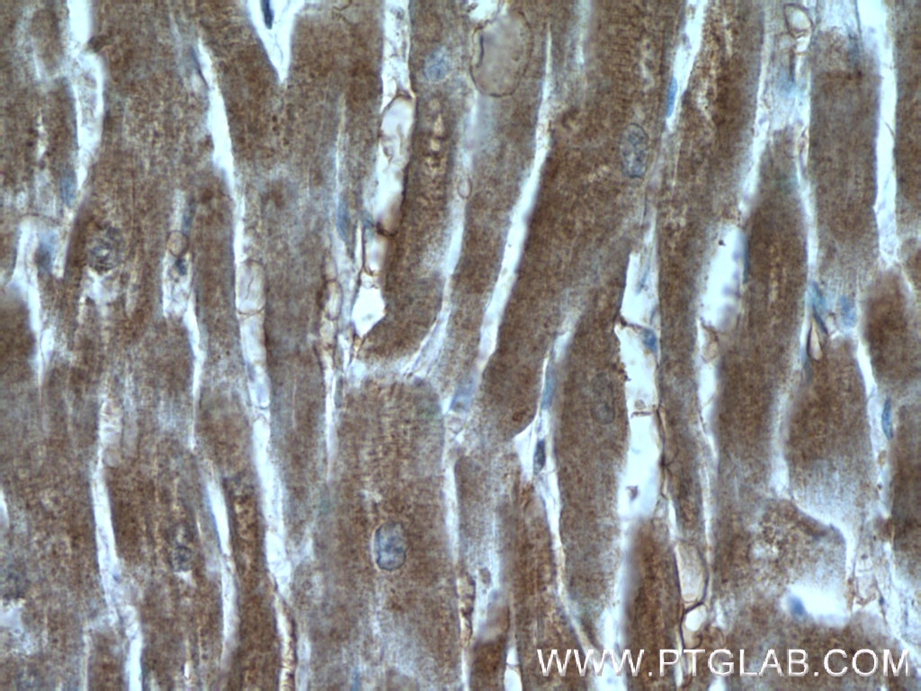 Immunohistochemistry (IHC) staining of human heart tissue using HMGCR Polyclonal antibody (13533-1-AP)