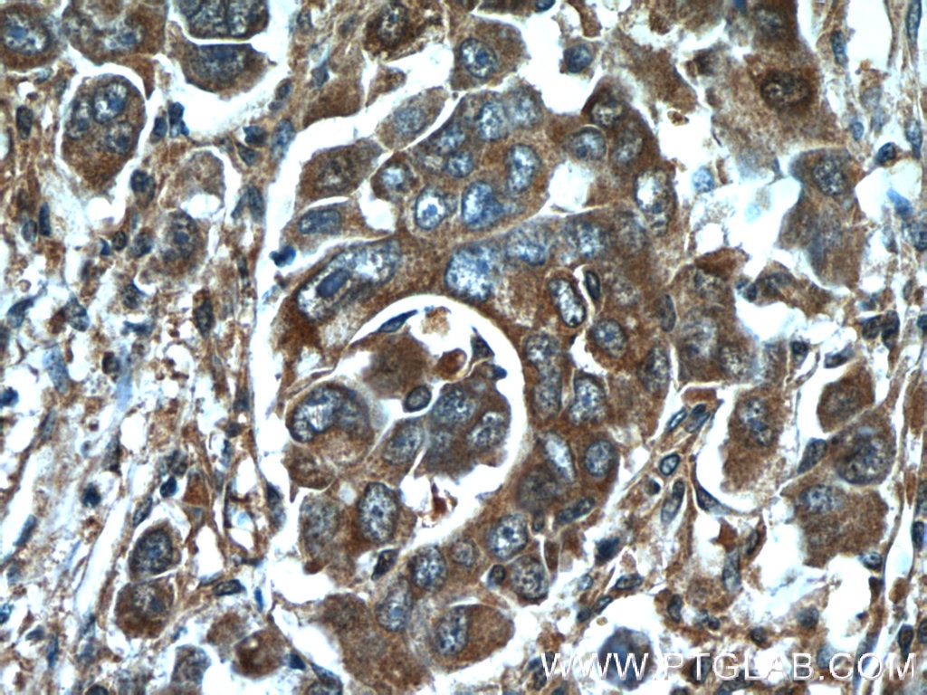 HMGCR Polyclonal antibody