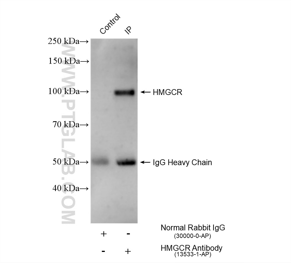 Immunoprecipitation (IP) experiment of HeLa cells using HMGCR Polyclonal antibody (13533-1-AP)